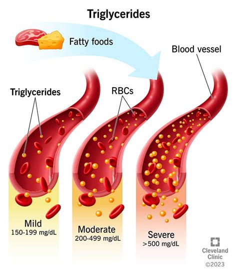 triglyceride test from drop of blood|triglycerides acceptable range.